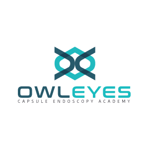 owleyes
